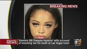A piece of his tooth was found on the floor of a room at the cosmopolitan. Steelers Player Is Injured In Domestic Violence Incident Report Fox Sports Radio