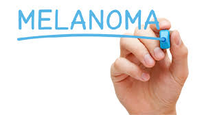 If you notice these warning signs, or anything new, changing or unusual on your skin see a dermatologist promptly. Melanoma Skin Cancer Symptoms Treatment Onco Com