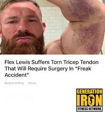 Seven-time 212 Olympia champion Flex Lewis shared that he suffered a torn  tricep tendon that will require surgery. Lewis “tore the tendon off bone”  while in a bathroom stall. Speedy recovery to