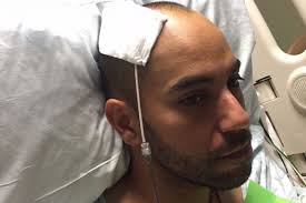 Fundraiser for Oscar Acosta by Kate McCarron Head : Please give to Oscar  Acosta