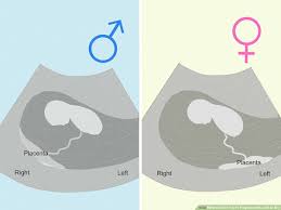 How To Tell If You're Pregnant With A Girl Or Boy (With Pictures)