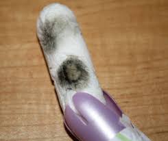 Check spelling or type a new query. Moldy Tampons Let S Talk Health