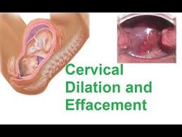 Precise Cervix Dilation Symptoms Self Check Dilation