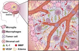 Streaming videos and concerts on the go eats hundreds of megabytes. Macrophages And Microglia The Cerberus Of Glioblastoma Acta Neuropathologica Communications Full Text