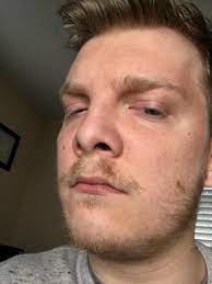 The blonde facial hair is quite hard to miss and fans took to twitter to express their complicated feelings on the matter. Any Tips For Blondes Facial Hair Growing In With So Many Shades Of Blonde Looks Baadddddd Beardadvice