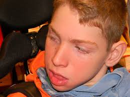 Raising Daniel Hasselberger, a journey with Polymicrogyria: October 2011