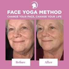 Pin On Before And After
