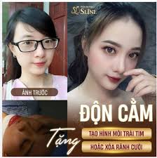 ĐỘN CẰM XINH SANG