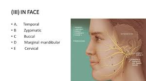 facial nerve by Dr. Roop