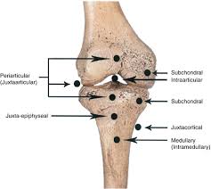 You must have a cengage account. Basic Sciences Of Bone And Joint Diseases Springerlink