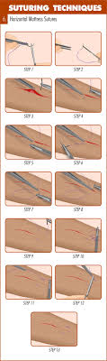 We did not find results for: Complete Guide To Mastering Suturing Techniques