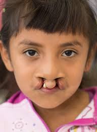 Mercy Outreach Surgical Team