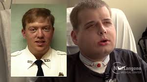 Badly Burned Firefighter Gets A New Face