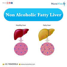 Image result for Liver Function Test
