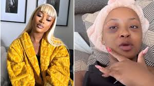 Yoh, guys, Cyan Boujee just exposed the worst kind of abuse. 😳 Her  ex-boyfriend literally beat her up to the point where her face looks like a  warzone! Bruises everywhere. 💔 She