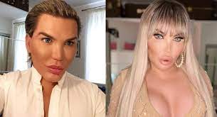 Ver más ideas sobre inspiración entrenamiento, ejercicios, before and after weightloss. Ken Humano Reaparece Como La Barbie Humana E Impacta Con Fotos En Bikini Erizos