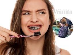 Borang permohonan bagi penempatan di pejabat miti luar negeri. Sebelum Buat Rawatan Braces Di Klinik Kerajaan Ambil Tahu Waktu Operasinya Mingguan Wanita