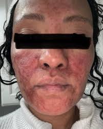 Brown skin girls….. Here's a glimpse in the life of my career, past and  present.... l've learned so much over the years in this amazing ever  changing industry! From my experience with