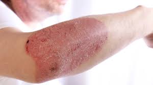 Image result for Humularia