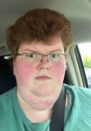 Weight Loss Progress: Embracing My Journey