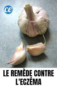 Epingle Sur Astuce Sante