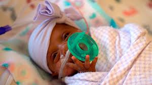 A fun apple sorting activity for toddlers. Girl Believed To Be Tiniest Newborn Weighed As Much As Apple Abc News