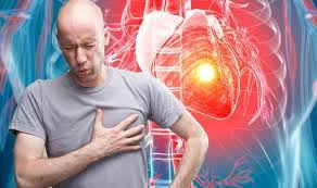 La cardiopatia ischemica comprende diverse patologie cardiache caratterizzate da un insufficiente rifornimento di ossigeno al muscolo cardiaco. Infarct Miocardic Boala IschemicÄ CardiacÄ ProgrameazÄ Te La Medic