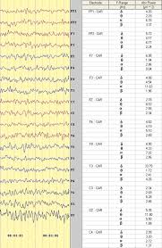 Brain Waves An Overview Sciencedirect Topics