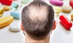 But if you are also taking birth control pills as your method of contraception, some insurance plans may cover all or a portion of the cost. Best Supplements For Hair Loss Viviscal Maximum Strength Proven To Promote Hair Growth Express Co Uk