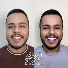 د.علي السرحان Dr.Ali Al Sarhan‎ (@dr.ali.alsarhan) • Instagram photos and  videos