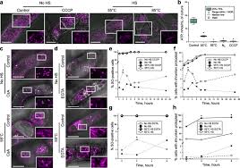 We did not find results for: Apoptosis Is Not Conserved In Plants As Revealed By Critical Examination Of A Model For Plant Apoptosis Like Cell Death Springerlink