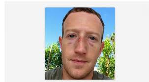 Quién le partió la cara a Mark Zuckerberg?