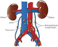 Image result for icd 9 code for retroperitoneal adenopathy