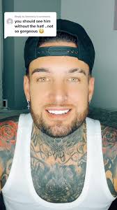 Replying to @tammlou Reply to @tammlou hair done by @Now Hair Time Hair  Transplant #fyp #foryou