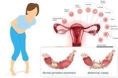 5 Life Changing Ways To Stop Your Period Cramps Menstrual Cramps Remedies For Menstrual Cramps Period Cramps