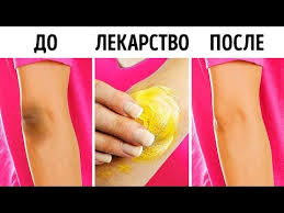 как убрать мертвую кожу с ног с помощью аспирина 10 Effektivnyh Priemov Chtoby Osvetlit Koleni I Lokti Youtube