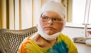 1000 Lb Sisters: When Will Tammy Slaton Get Skin Removal Surgery For Her  Legs?