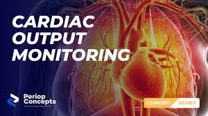 Image result for Cardiac Output
