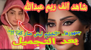 البساطه ؛ الهدوء ؛ حب الحياة ؛ حب الناس ؛ هذي أنا ببساطه. Ø£Ù†Ù Ø±ÙŠÙ… Ø¹Ø¨Ø¯Ø§Ù„Ù„Ù‡ ÙŠØªØµØ¯Ø± Ø§Ù„ØªØ±Ù†Ø¯ Ø¨Ø¹Ø¯ Ø¹Ù…Ù„ÙŠØ© ØªØ¬Ù…ÙŠÙ„ Youtube