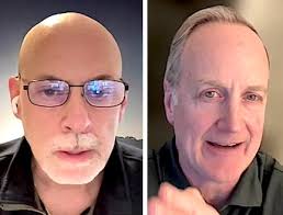 Officials warm to the idea of fire pits at Compo Beach