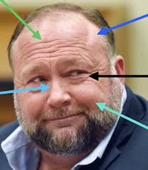 Why is Steve's chin built like that?