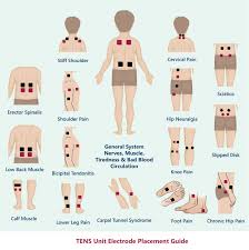Pin On Tens Placement