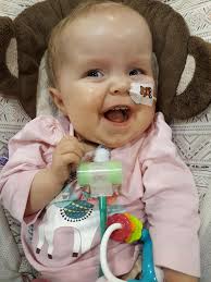 Hi everyone Monica is doing amazing. The only problem is we are having to  go really slow with increasing her feed to get the 8 hours break at night  that makes it