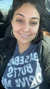 What is the best anti-aging product for forehead wrinkles?