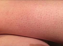 This Is The Gross Reason You Get Little Red Bumps On Your Legs After Shaving