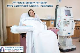 Dialysis Fistula Surgery Tampa Dialysis Renal Dialysis Peritoneal Dialysis