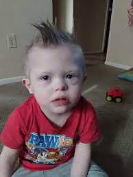 Kids with Down Syndrome.