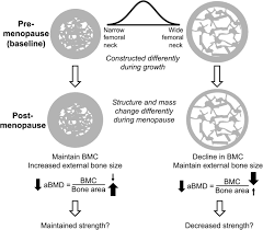 The Challenges Of Diagnosing Osteoporosis And The Limitations Of Currently Available Tools Clinical Diabetes And Endocrinology Full Text