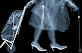 Enjoy yourself on xray game. Incredible X Ray Artwork Pictures Show What S Going On Under People S Clothes From Strippers To Stoners Mirror Online