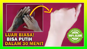 Cara Memutihkan Kulit Secara Alami Kulit Tangan Wajah Pemutih Kulit Kulit Pemutih